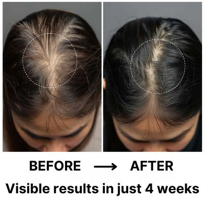 Virtros Hair Therapy Comb