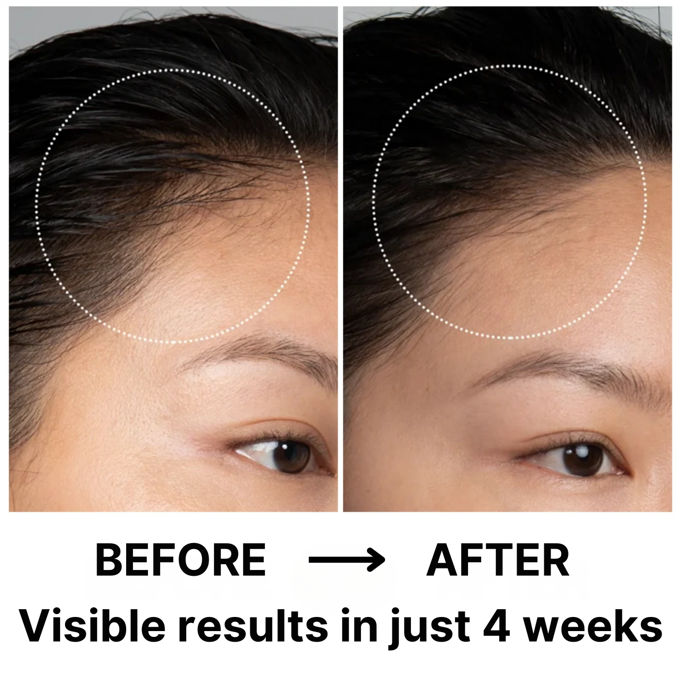 Virtros Hair Therapy Comb