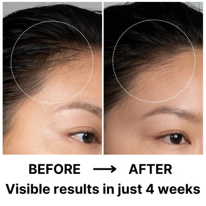 Virtros Hair Therapy Comb